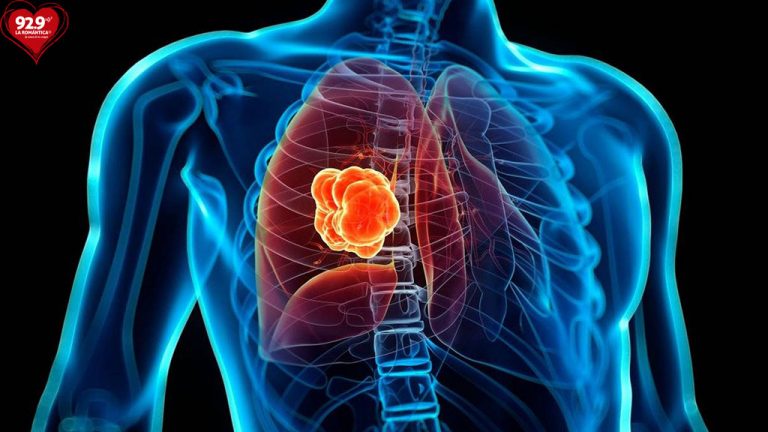 Día Nacional del Cáncer de Pulmón