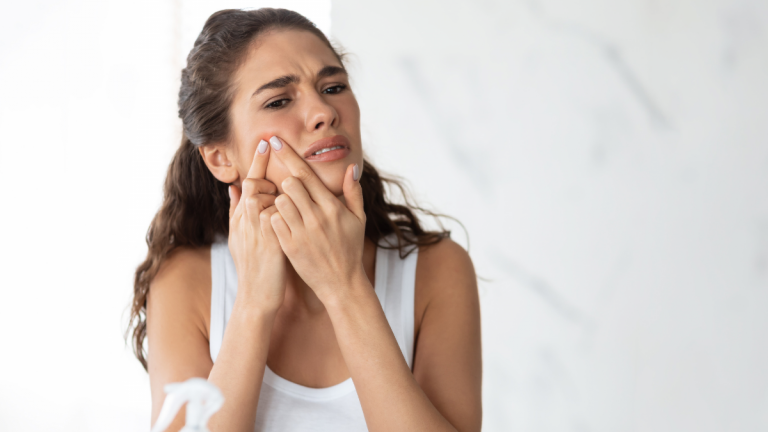 5 cosas que provocan acné