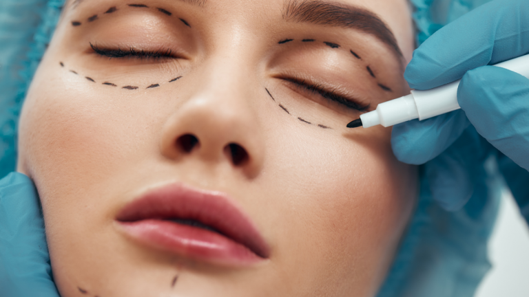 Famosos que cambiaron radicalmente con cirugías